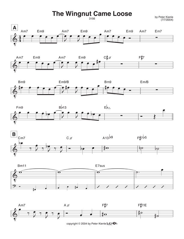 The Wingnut Came Loose